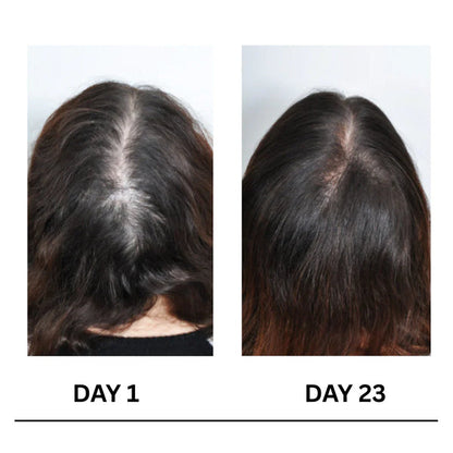Scalpy Boost+ Hair Growth