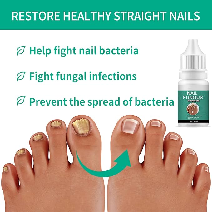 Nexusdrop Nail Fungus Solution